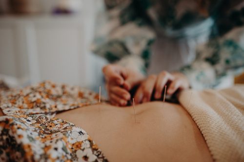 Acupuncture for Digestion